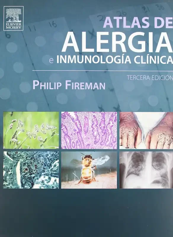 Atlas de alergia e inmunología clínica