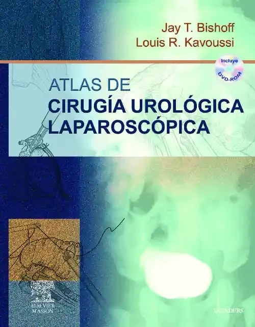 Atlas de cirugía urológica laparoscópica + DVD-ROM