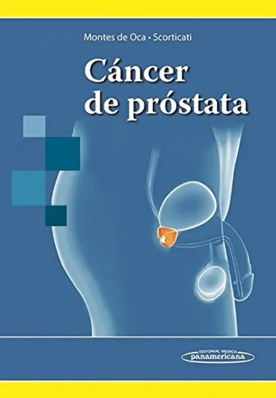 Cáncer de próstata