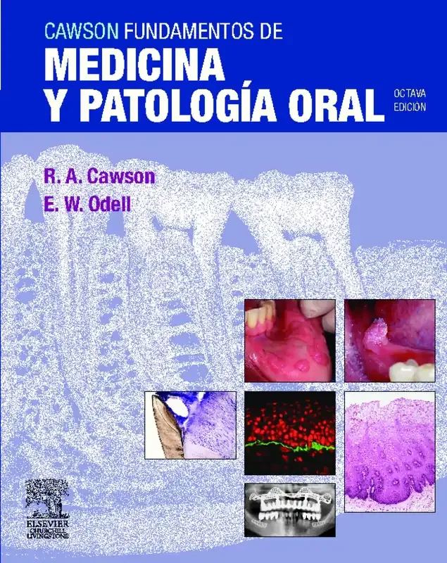 Cawson. Fundamentos de medicina y patología oral