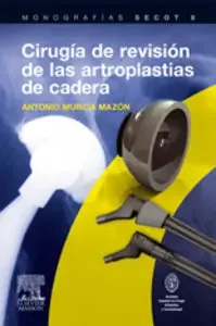 cirugía de revisión de las artroplastias de cadera