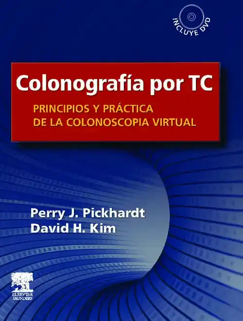 Colonografía por TC Principios y práctica de la colonoscopia virtual + DVD