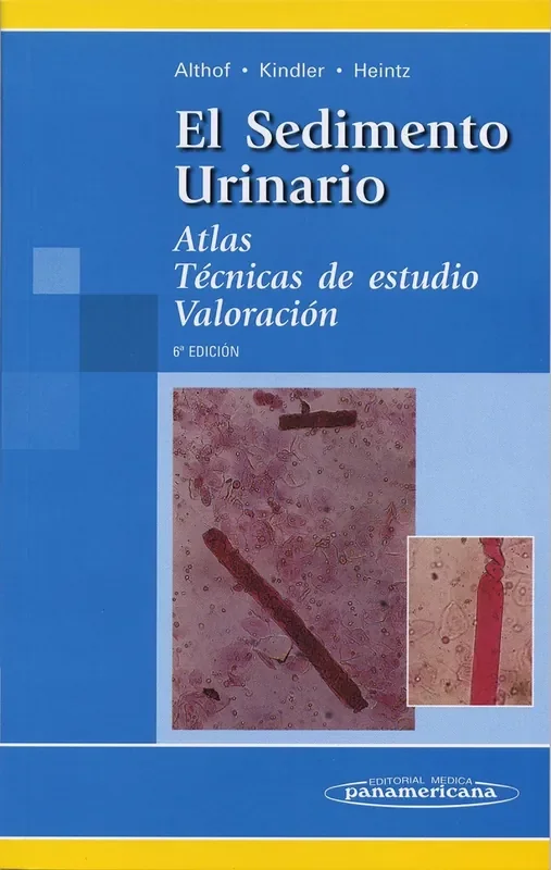 El Sedimento Urinario. Atlas. Técnicas de estudio. Valoración