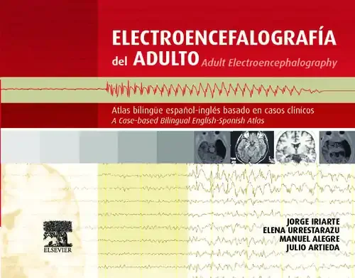 Electroencefalografía del adulto