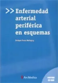 Enfermedad arterial periférica en esquemas