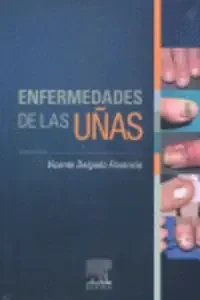 Enfermedades de las uñas
