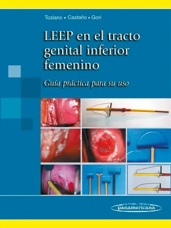 LEEP EN EL TRACTO GENITAL INFERIOR FEMENINO