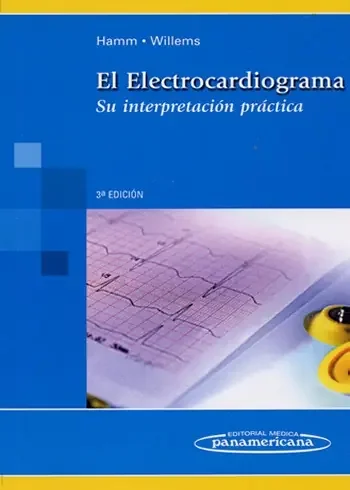 LISTA DE CONTROL. ELECTROCARDIOGRAMA
