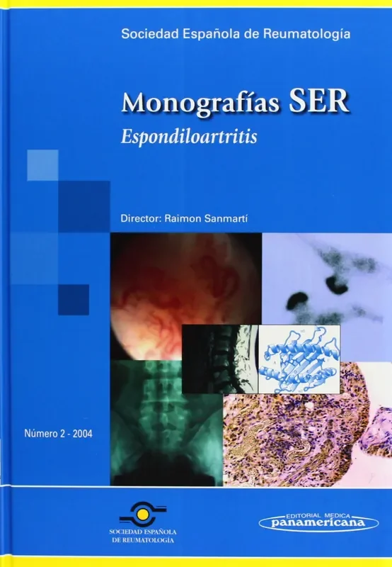 Monografías SER. Espondiloartritis