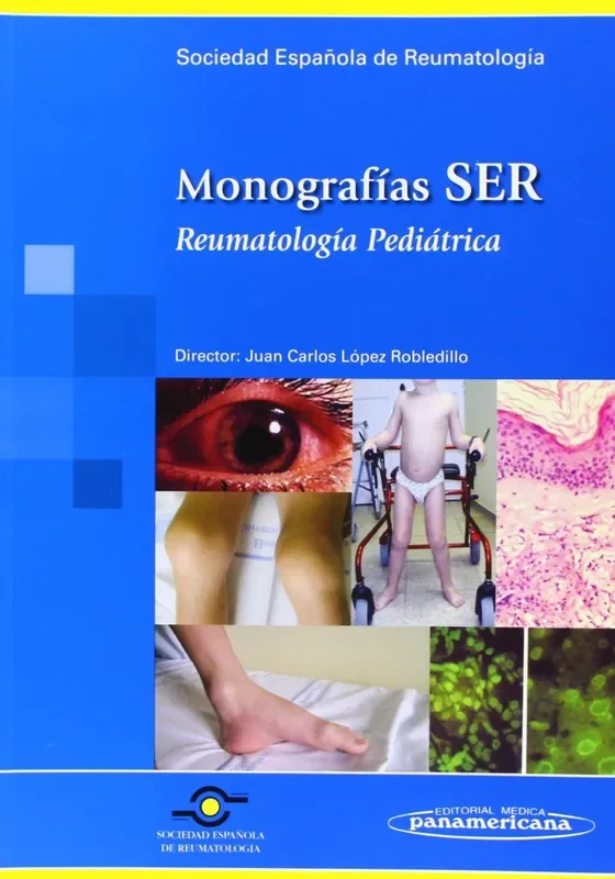 Monografías SER. Reumatología Pediátrica