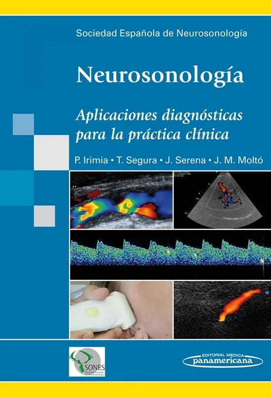 NEUROSONOLOGÍA