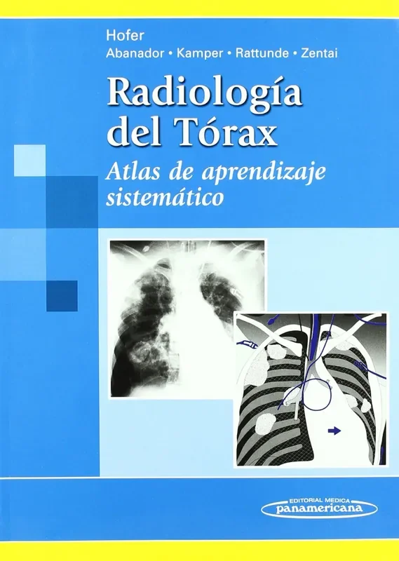 Radiología del Tórax. Atlas de aprendizaje sistemático