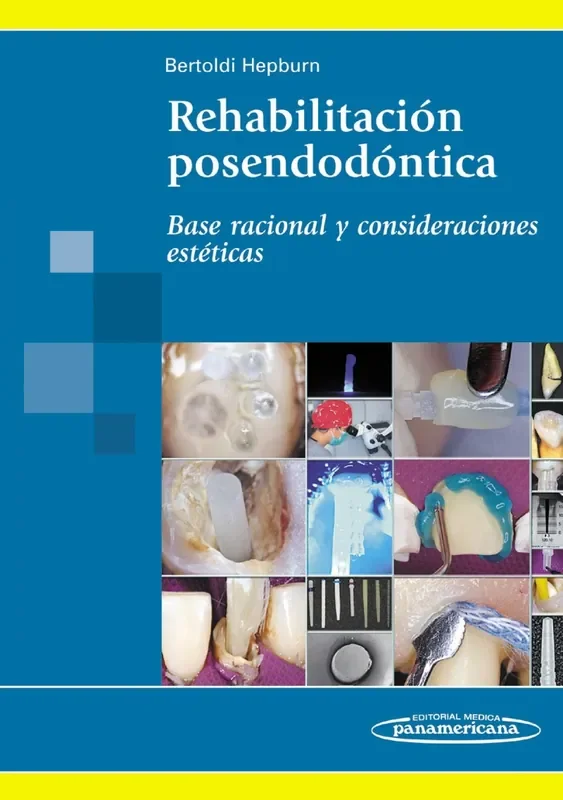 REHABILITACIÓN POSENDODÓNTICA