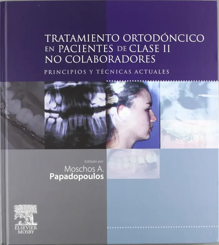 Tratamiento ortodóncico pacientes clase 2 no colaboradores. Principios y técnicas actuales
