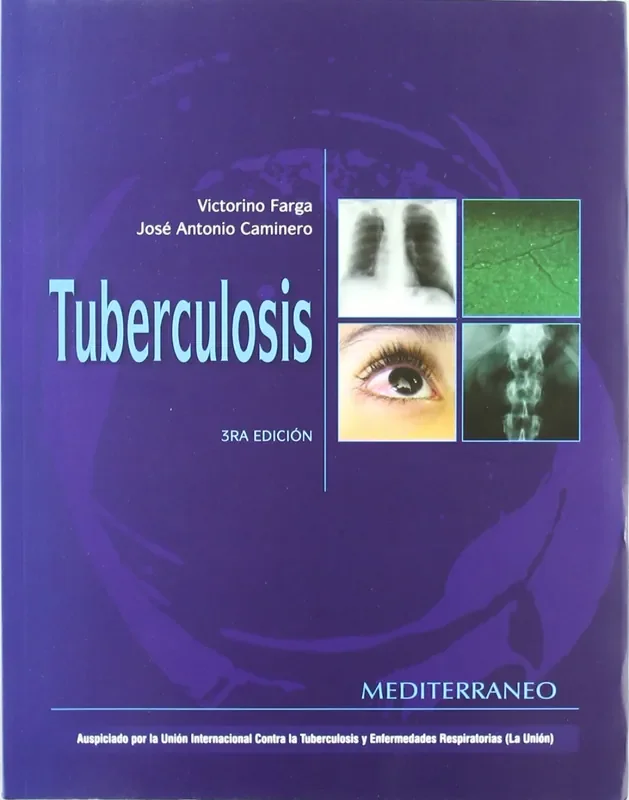 Tuberculosis